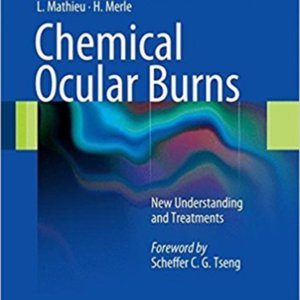 Chemical ocular burns.jpg