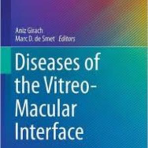 Diseases of vitreo-macular interface.jpg