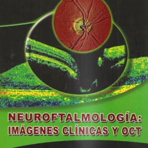 neuroftalmologia imagenes.jpg