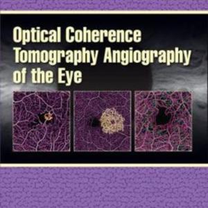 Optical coherence tomography angiography.jpg