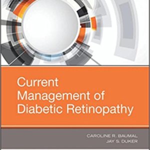 Current management of diabetic retinopathy.jpg