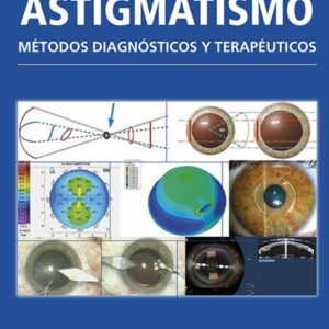 Astigmatismo metodos diagnosticos.jpg