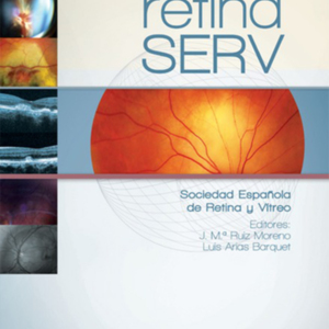 manual-retina-serv.jpg manual-retina-serv.jpg