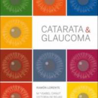 catarata y glaucoma.jpg