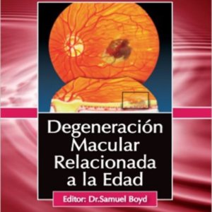 Degeneracion macular.jpg