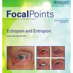 Focal Point 32-2 ectropion.jpg