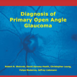 Diagnosis of primary open angle glaucoma.jpg