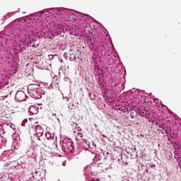 Figura 2