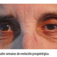 Figura 8. Cuatro semanas de evolución posquirúrgica.