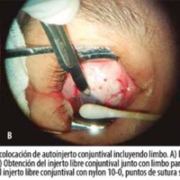 10_1_02_Vasquez_fig_2.jpg