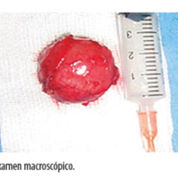 Figura 5. Examen macroscópico.