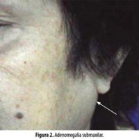 10.1_03_Levaggi_fig_2.jpg