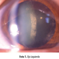 Foto 1. Ojo izquierdo