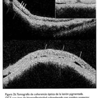 02_04_03_Gentile_fig_2b.jpg