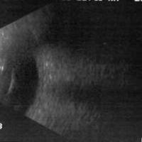 03_02_07_Waisman_fig_5.jpg