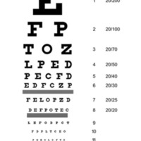 Registro de la agudeza visual sub-20/200 en pacientes con ambliopía profunda y baja visión mediante optotipos de escala logarítmica