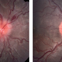 Fig.1