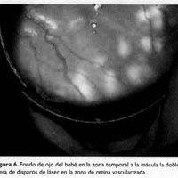 02_04_02_Larrea_fig_6.jpg