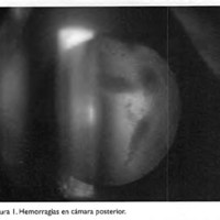 02_04_09_Gadea_fig_1.jpg