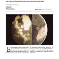 OCE 10.4.5 - Rozenbaum.pdf