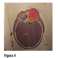 OCE_06_02_03_Welschen_fig_4.jpg