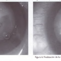 02_02_03_Badoza_fig_5_6.jpg