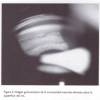 02_02_09_Mancini_fig_2.jpg