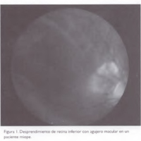 02_02_05_Berreta_fig_1.jpg