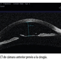 OCE_07_01_05_Laurencio_fig_2.jpg