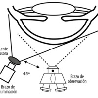 Desarrollo de un sistema experimental para la evaluación de imágenes de la superficie ocular