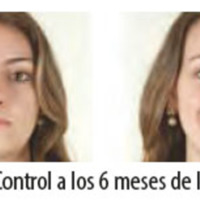 Figura 21. Control a los 6 meses de la cirugía.