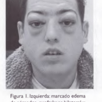 02_02_08_Devoto_fig_1.jpg
