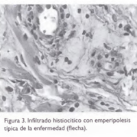 02_02_08_Devoto_fig_3.jpg