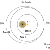 Retinopatía del prematuro