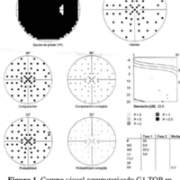 Figura 1. Campo visual computarizado G1 TOP en el cual se evidencia disminución generalizada de la sensibilidad, defecto campimétrico 360°.