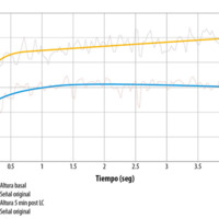 Figura 6. Gráfico donde se compara la diferencia de altura del menisco lagrimal en función del tiempo: en celeste la altura basal y en amarillo la altura a los cinco minutos posteriores de retirar la lente de contacto. Se observa cómo el menisco no se recupera y queda en alturas menores.