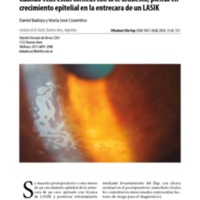 OCE 11.4.4 -  Badoza.pdf