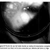02_04_02_Larrea_fig_5.jpg