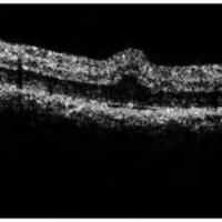 03_02_07_Waisman_fig_10.jpg