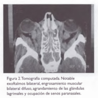 02_02_08_Devoto_fig_2.jpg
