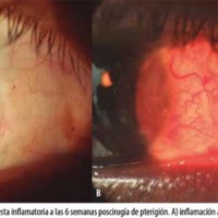 10_1_02_Vasquez_fig_4.jpg