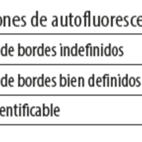 Tabla 2
