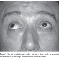 01_01_07_Gadea_fig_3.jpg