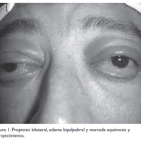 01_01_07_Gadea_fig_1.jpg