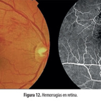 fig_12.jpg
