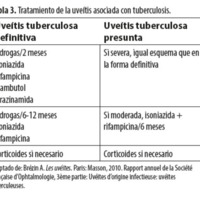 Tabla 3. Tratamiento de la uveítis asociada con tuberculosis.