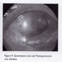 04_02_04_Chiaradia_fig_9.jpg
