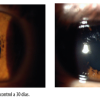OCE_07_01_05_Laurencio_fig_3_4.jpg