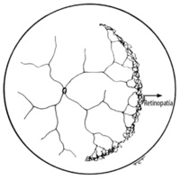 Figura 3. Extensión de la ROP.